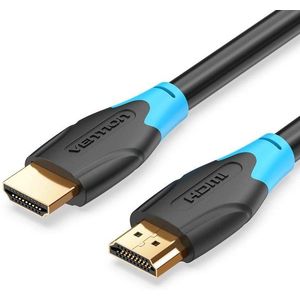 Vention HDMI 2.0 High Quality Cable 0, 75 m Black kép