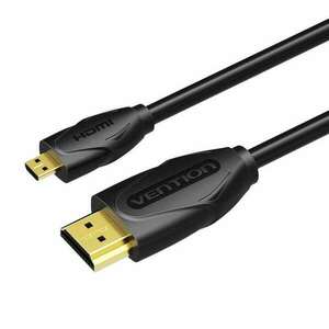 Vention HDMI - Micro HDMI kábel 1, 5m fekete (VAA-D03-B150) (VAA-D03-B150) kép