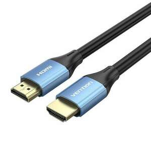 Vention ALHSF HDMI kábel 1 M HDMI A-típus (Standard) Kék (ALHSF) kép