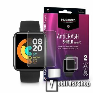 MyScreen Protector AntiCrash Shield Edge3D okosóra képernyővédő fólia - Ultra Clear, ÖNREGENERÁLÓ! - 2db - Xiaomi Mi Watch Lite / Xiaomi Redmi Watch - GYÁRI kép