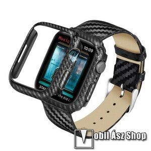 Okosóra szíj / műanyag tok - FEKETE KARBON MINTÁS - valódi bőr szíj, műanyag védő keret, 115mm + 95mm hosszú - APPLE Watch Series 7 (45mm) / Series 8 (45mm) / Series 9 (45mm) kép