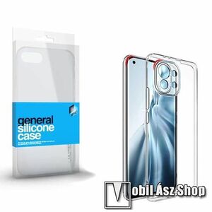Xpro szilikon védő tok / hátlap - ULTRAVÉKONY! 0.33mm - ÁTLÁTSZÓ - Xiaomi Mi 11 Lite / Xiaomi Mi 11 Lite 5G - GYÁRI kép