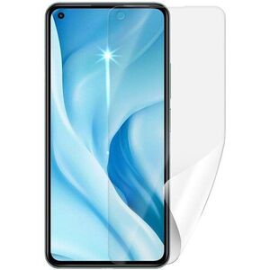 Screenshield Anti-Bacteria XIAOMI 11 Lite 5G NE kijelzővédő fólia kép