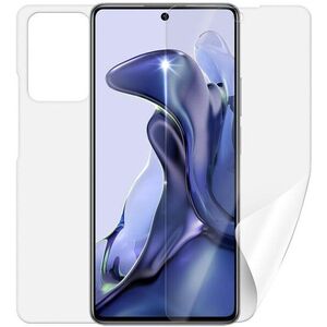 Screenshield XIAOMI 11T kijelzővédő fólia kép
