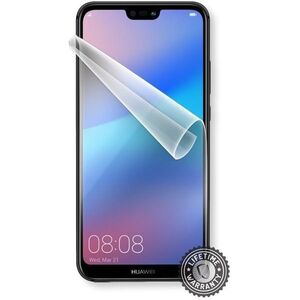 Screenshield HUAWEI P20 kijelzővédő fólia kép
