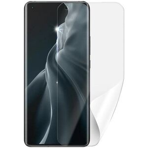 Screenshield XIAOMI Mi 11 kijelzővédő fólia kép