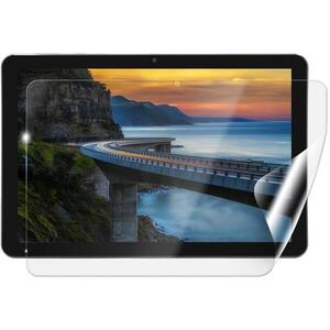 Screenshield IGET Smart W30 védőfólia kép