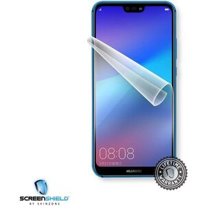 Screenshield HUAWEI P20 Lite kijelzővédő fólia kép