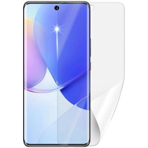 Screenshield HUAWEI Nova 9 kijelzővédő fólia kép