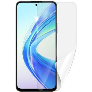 Screenshield HUAWEI Honor X7b védőfólia kép