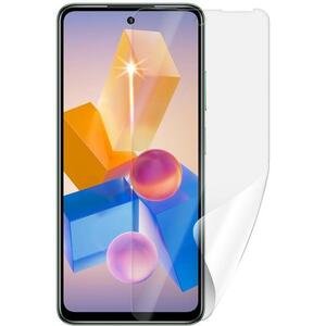 Screenshield INFINIX Hot 40 PRO védőfólia kép