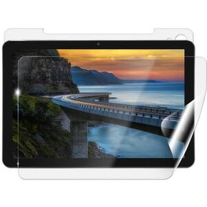 Screenshield IGET Smart W30 védőfólia kép