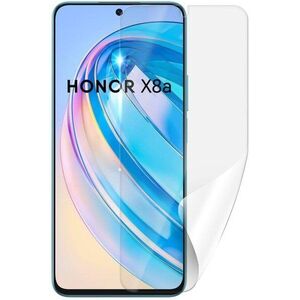 Screenshield HONOR X8a kijelzőre kép