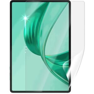 Screenshield HUAWEI Honor Pad X8a védőfólia kép