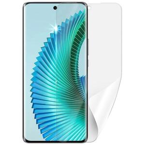 Screenshield HUAWEI Honor Magic 6 Lite 5G védőfólia kép