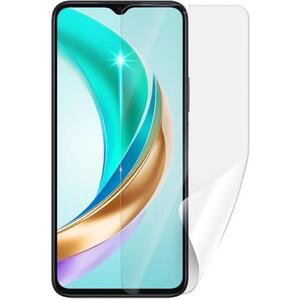 Screenshield HUAWEI Honor X6b védőfólia kép